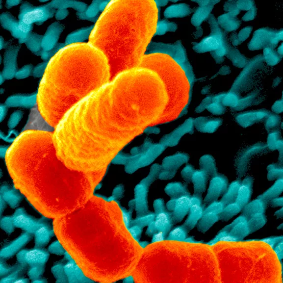 Bactéries Escherichia coli O104:H4 (souche 55989) en interaction avec des cellules de l'épithélium intestinal humain (lignée T84). 
