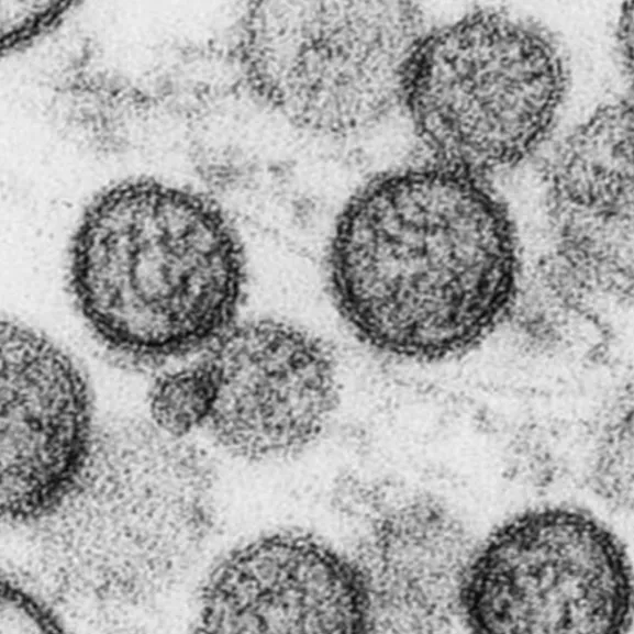 Hantavirus