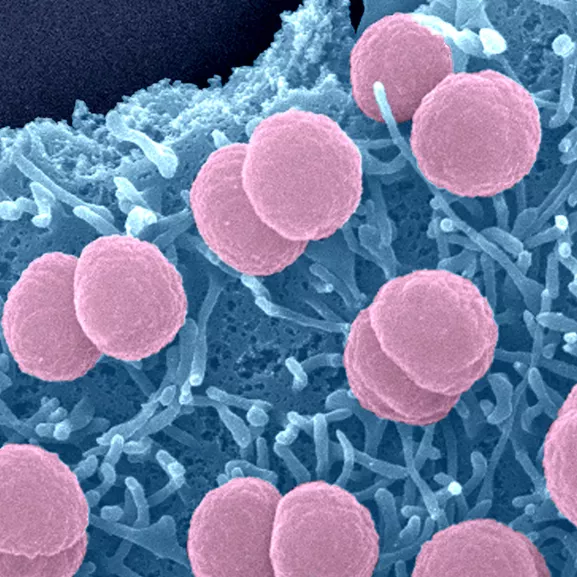 Bactéries Neisseria meningitidis adhérant à la surface de cellules épithéliales - Institut Pasteur