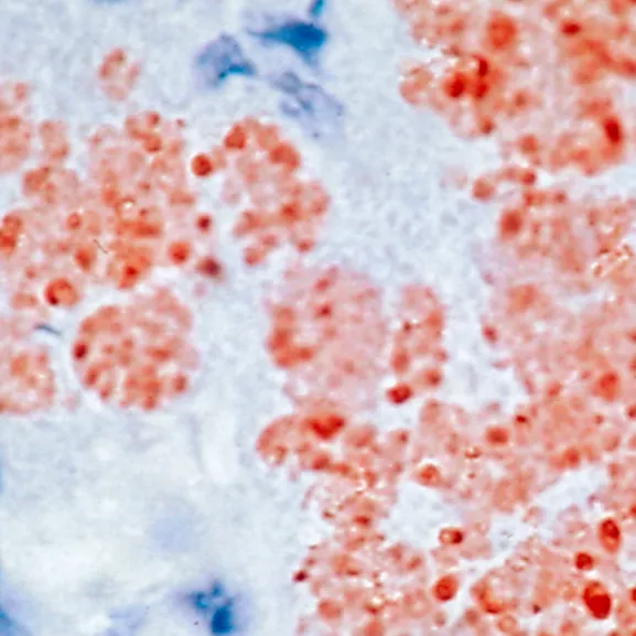 Foie de souris expérimentalement infecté par le bacille de la peste Yersinia pestis - Institut Pasteur