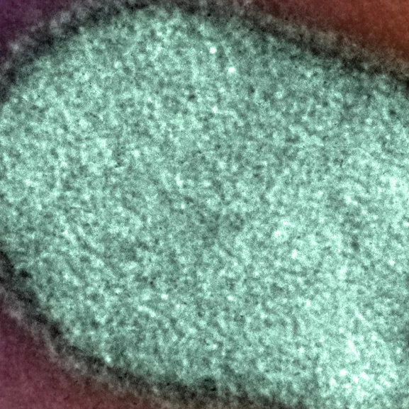 Virus de la rage en microscopie électronique. Image colorisée - Institut Pasteur