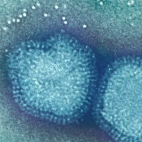 Virus de la grippe type A - Institut Pasteur