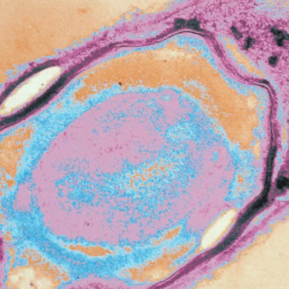 Bactéries anaérobies et botulisme - Institut Pasteur