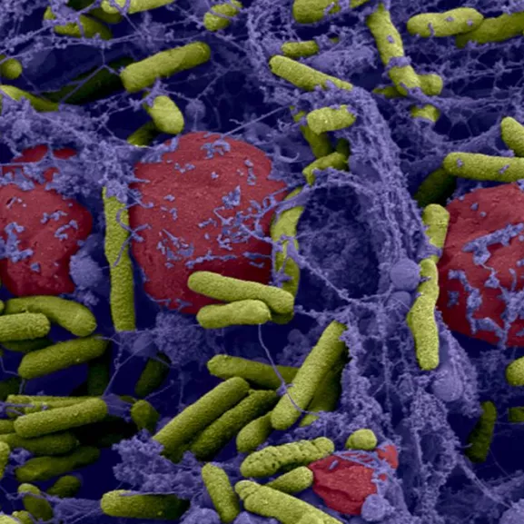 Photographie de microscopie colorisée
