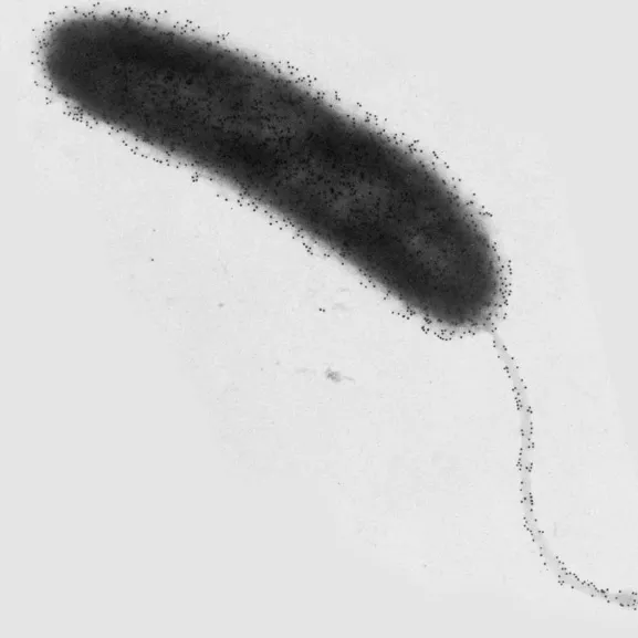 Vue en microscopie électronique d'un vibrion cholérique - Institut Pasteur