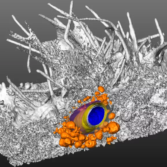 Image en coupe d’une Shigella flexneri au cœur du foyer d’infection sur une cellule Hela