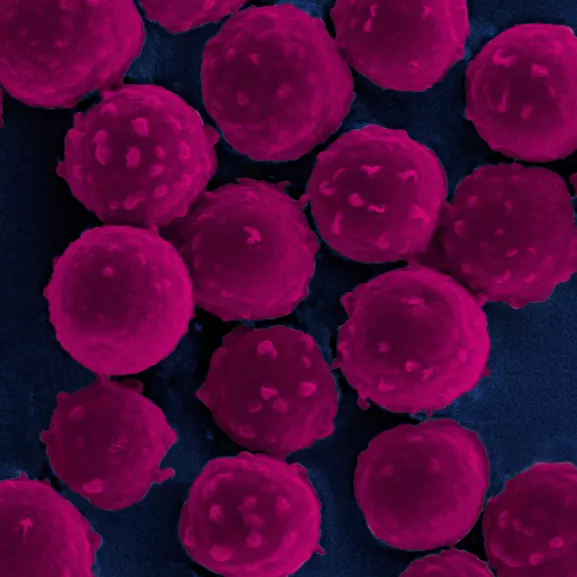 Conidies du champignon filamenteux Aspergillus fumigatus en microscopie électronique à balayage