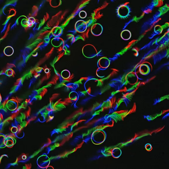 Glissements circulaires du parasite Plasmodium, responsable du paludisme, sur lame de verre