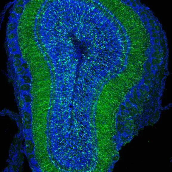 Coupe de cerveau de souris observée en microscopie à fluorescence.