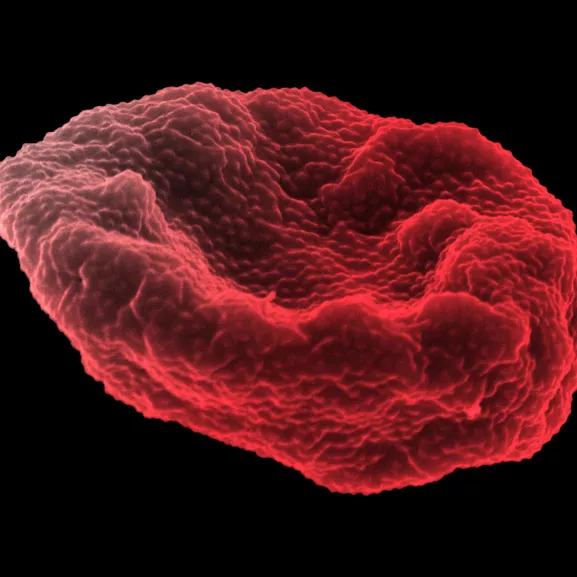 Globule rouge humain infecté par Plasmodium falciparum