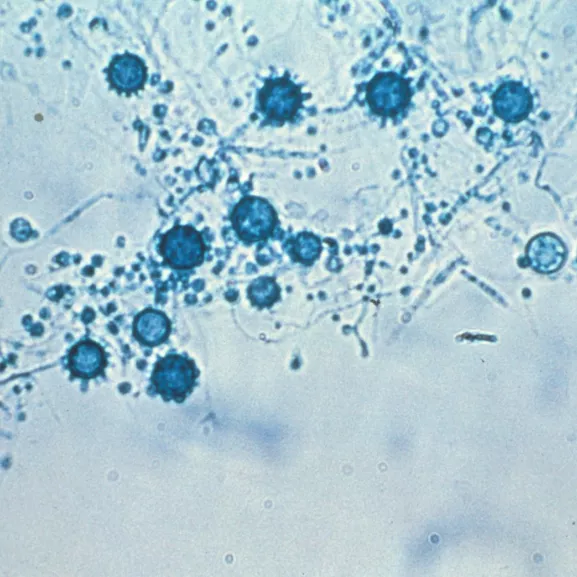Histoplasma capsulatum