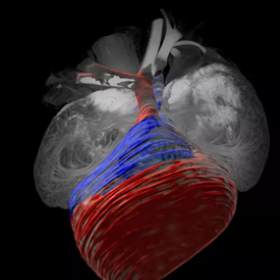 coeur