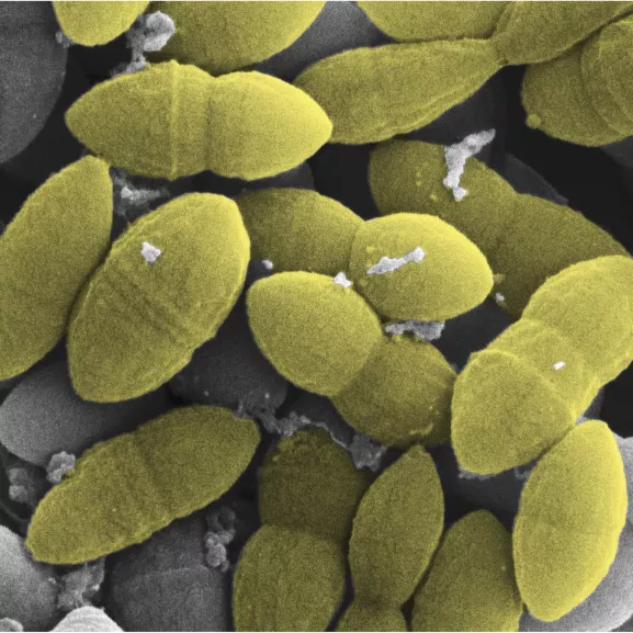 Images au microscope électronique à balayage (MEB) de cellules de M. smithii (ou Methanobrevibacter smithii), une espèce d'archées méthanogènes.