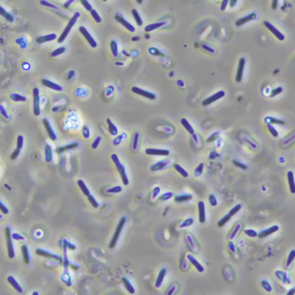 observation au microscope d’une culture de Clostridium botulinum à l’état frais (grossissement x1000).