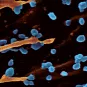 Fiches maladies -Chikungunya - Institut Pasteur