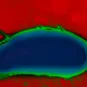 Fiches maladies - Choléra - Institut Pasteur