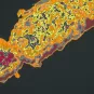 Fiches maladies - Coqueluche - Institut Pasteur