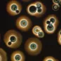 Fiches maladies - Cryptococcose - Institut Pasteur