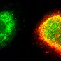 Fiches maladies - Fièvre de Lassa - Institut Pasteur