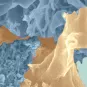 Fiches maladies - HTLV-I - Institut Pasteur