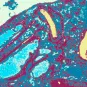 Fiches maladies - Leishmanioses - Institut Pasteur