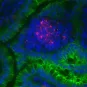 Listeria monocytogenes (rouge/red) - Institut Pasteur