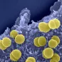 Fiches maladies - Méninges à méningocoques - Institut Pasteur
