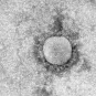 Fiches maladies - MERS-COV - Institut Pasteur
