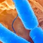 Fiches maladies - Shigellose - Institut Pasteur