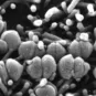 Fiches maladies - Streptocoques A et B - Institut Pasteur