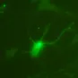 Fiches maladies - West Nile - Institut Pasteur