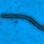 Virus Ebola vu en microscopie électronique à transmission - Institut Pasteur