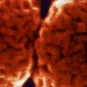 Santé Publique - CCOMS - Méningite - Institut Pasteur