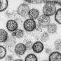 Hantavirus - Institut Pasteur