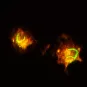 Infection de macrophage par le virus de la fièvre de la vallée du Rift.