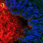 bactéries du colon. Comment le microbiote bloque les allergies