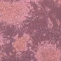Cellules en culture infectées par le coronavirus MERS-CoV 