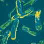 Pseudomonas aeruginosa, bactérie opportuniste, impliquée dans la mucoviscidose _ Institut Pasteur