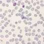 Transgenic P. falciparum schizont stage parasites with a natural polymorphism vaccine candidate antigen