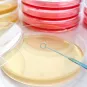 Le surcoût annuel des infections à bactéries résistantes en France estimé à 290 millions d'euros