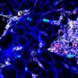 Listeria : des souches hypervirulentes à tropisme cérébral et placentaire - Institut Pasteur