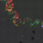 Dysenterie : Shigella, une bactérie qui s’adapte à toutes les respirations