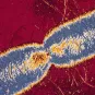 Nouvel éclairage sur la dissémination de la résistance aux carbapénèmes chez Escherichia coli