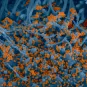 Photo d'un coronavirus réalisée par microscopie électronique et colorisée