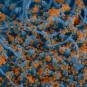 Crédit : Institut Pasteur. Image par Rémy Robinot, Mathieu Hubert, Vincent Michel, Olivier Schwartz et Lisa Chakrabarti, et colorisée par Jean Marc Panaud