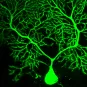 Brain connectivity and neurodegenerative diseases