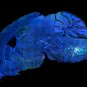Brain connectivity and neurodegenerative diseases - Institut Pasteur