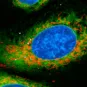 Legionellose : mécanisme inédit de régulation de la réponse immunitaire des cellules hôtes par la bactérie Legionella pneumophila