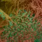 Cellules bronchiques humaines infectées par SARS-CoV-2