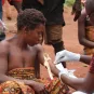 MonkeyPox - Institut Pasteur - Institut Pasteur de Bangui